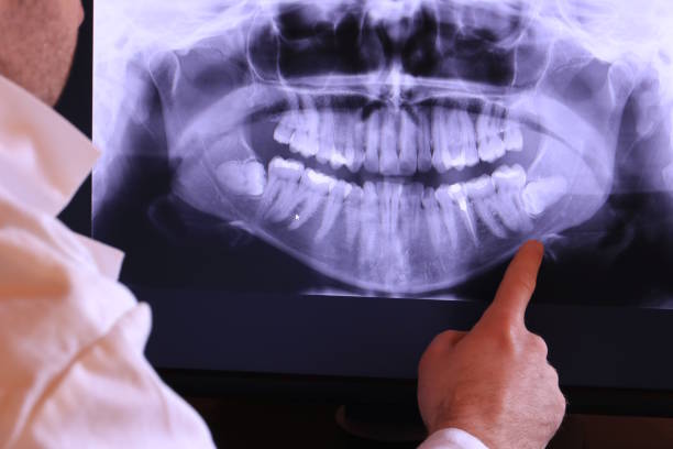 Best Broken or Cracked Tooth Emergency Dentist in West Point, KY